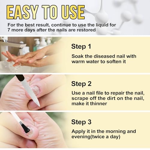 Toenail Fungus Treatment Extra Strength 30ml Z725749